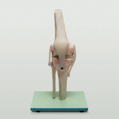 관절의 구조(무릎)